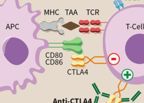 진행성 간암과 말기 간암의 차이점? 치료 방법은?