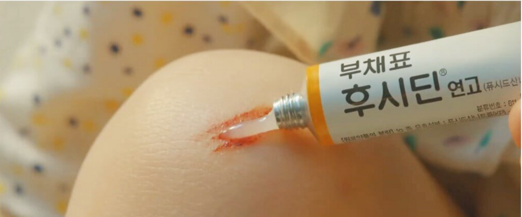 후시딘과-마데카솔-차이