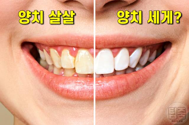 양치 세게하면,양치 세기,칫솔질 세게하면 이가 시려요