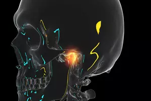 턱관절-치료방법