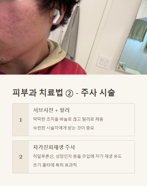 피부과 치료법 주사 시술