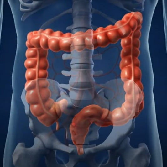 면역력을 높이는 방법