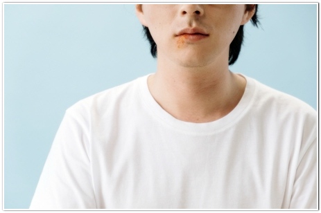 사마귀 제거방법