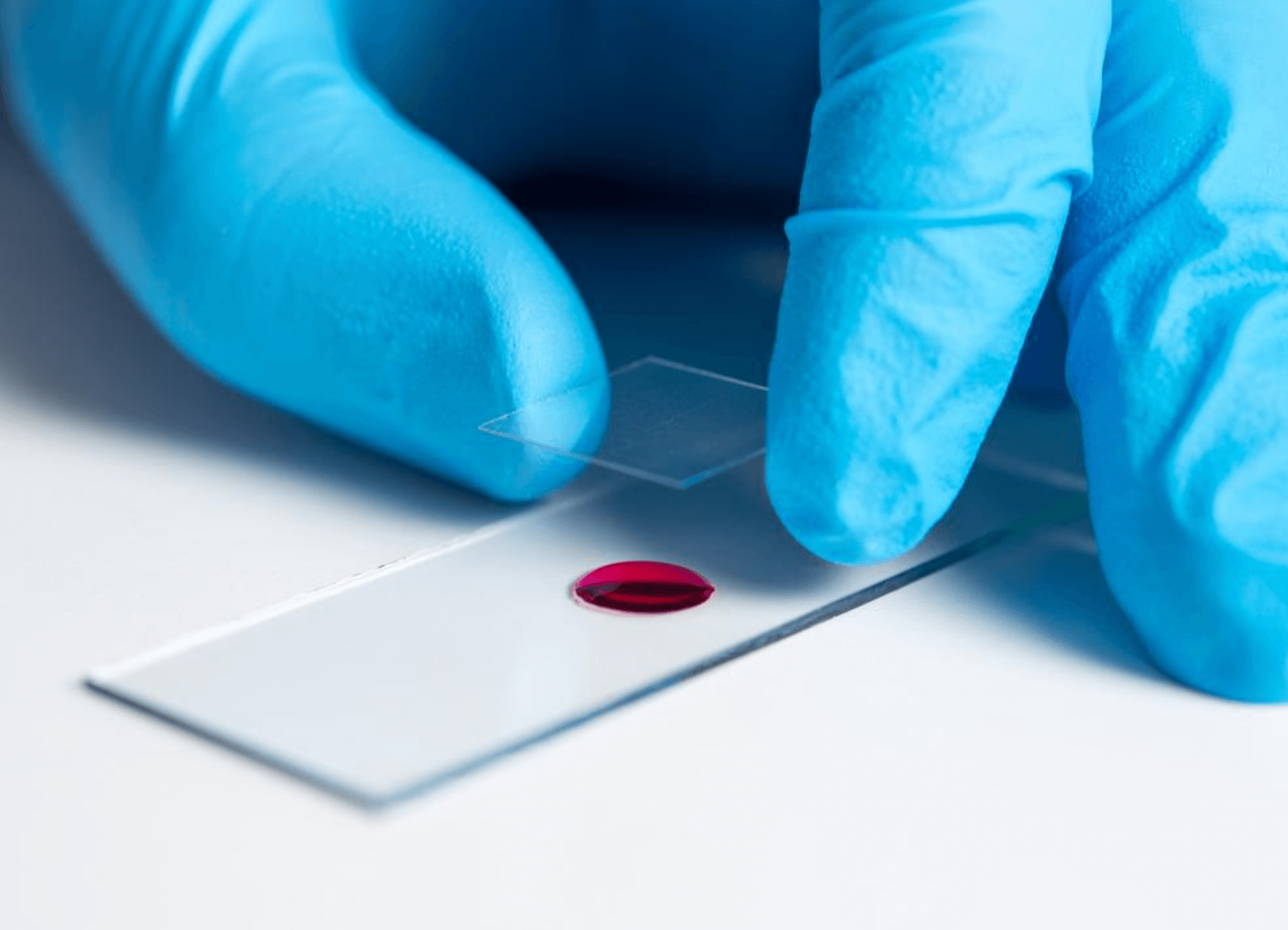 간장질환-피검사