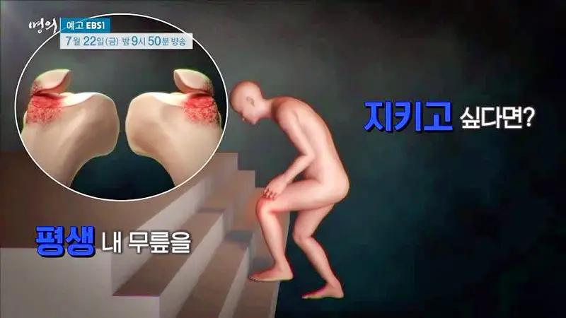 명의 수술 없이 무릎을 오래 쓸 마지막 기회 새 무릎으로 사는 법 치료법 정형외과 인용 교수, 재활의학과 이종인 교수