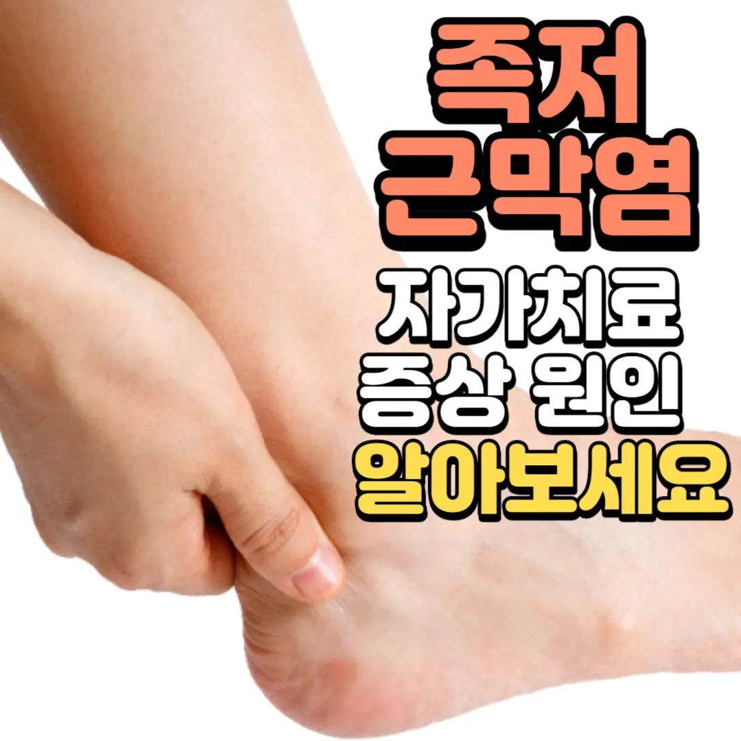 족저근막염 자가치료