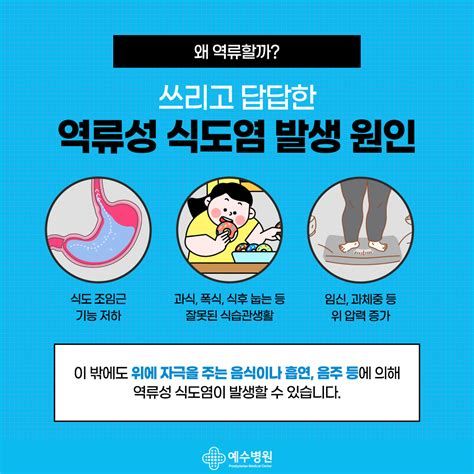 역류성식도염
