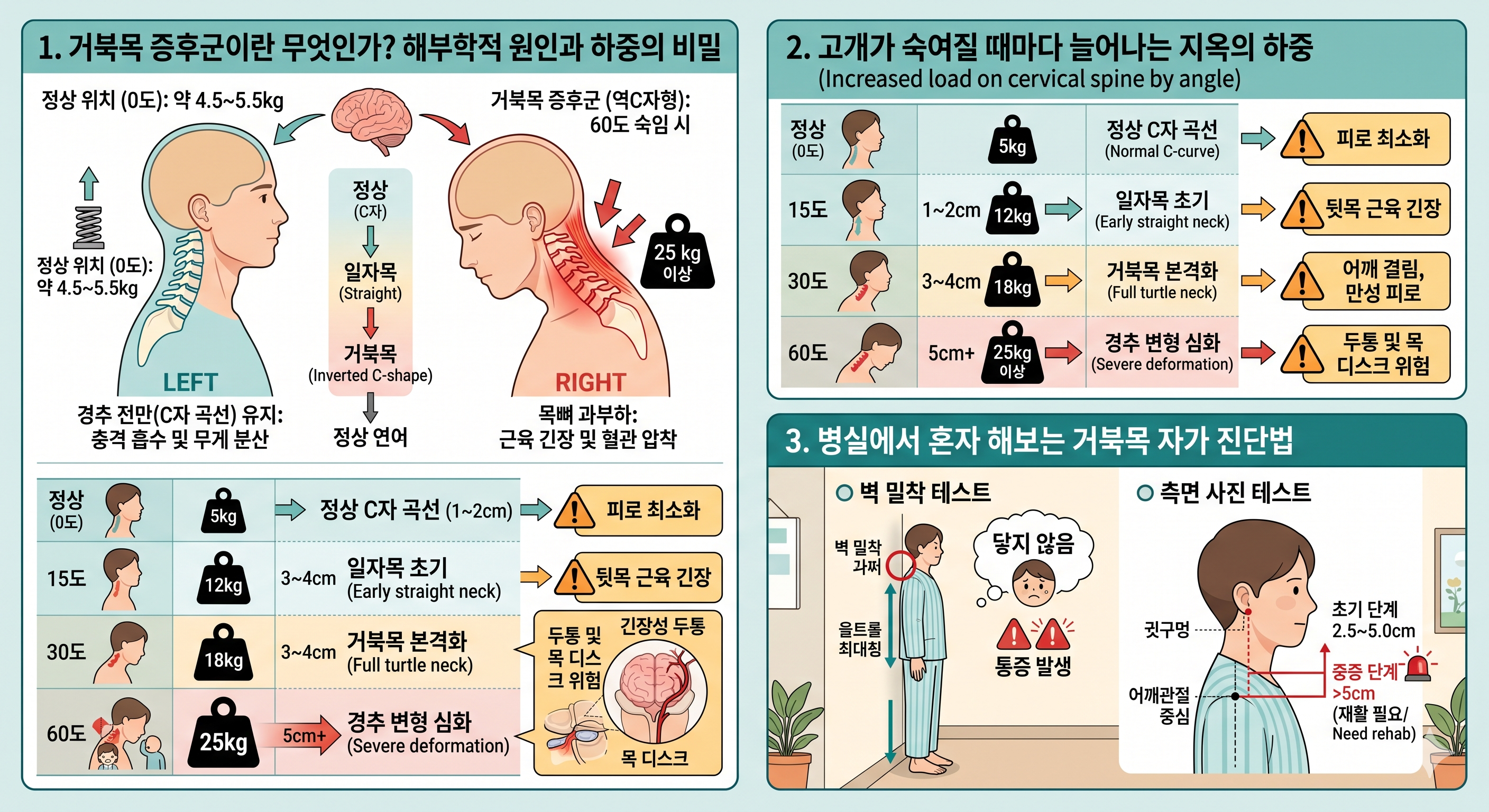 거북목 증후군이란 무엇인가? 해부학적 원인과 하중의 비밀