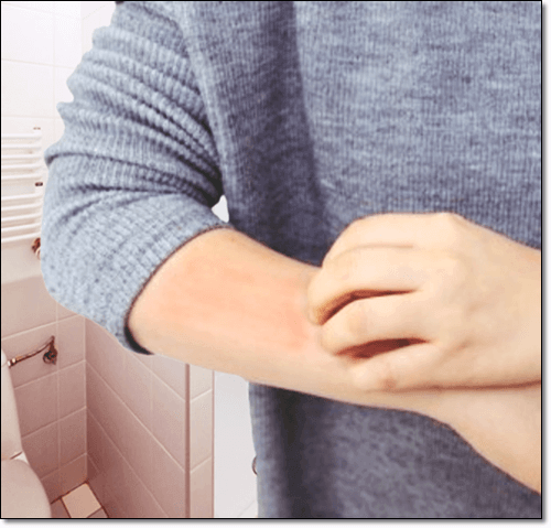 피부염이 있는 남성