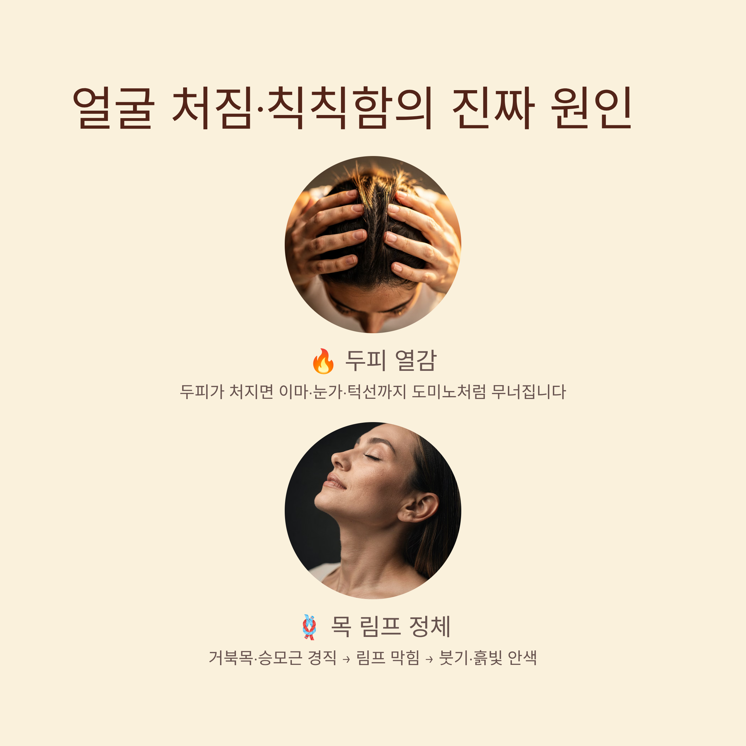 두피 열감