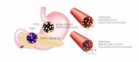 공복혈당 정상수치