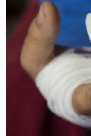 손가락마디통증