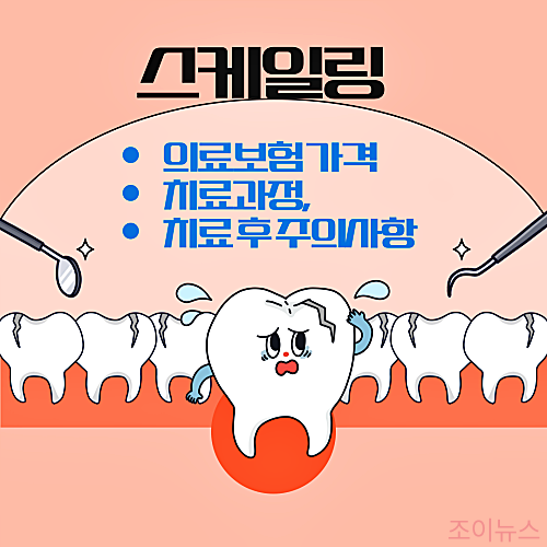 스케일링 의료보험, 가격, 치료과정, 주의사항까지 모두 알아보기(2024)