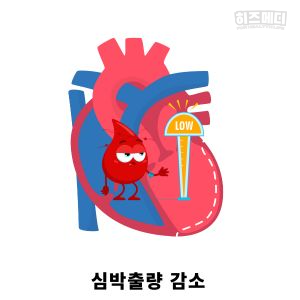 기립성 어지럼증