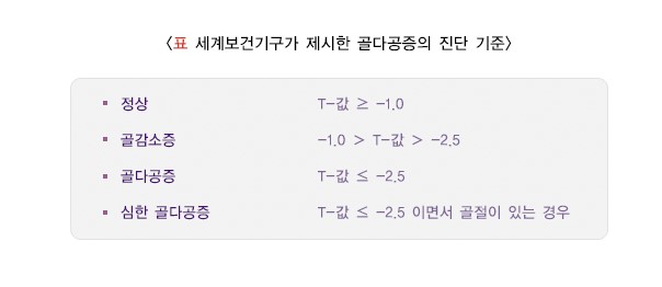골밀도 진단기준