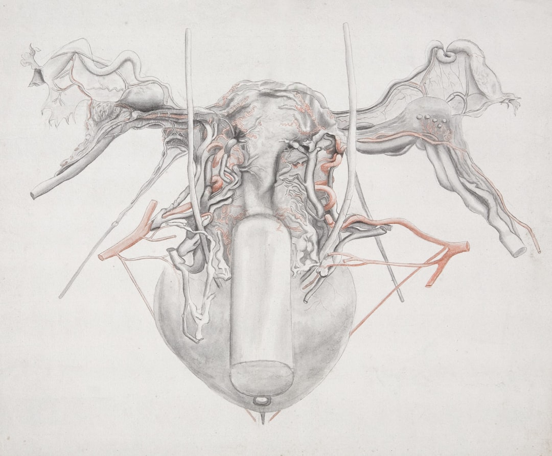 Thyroid.