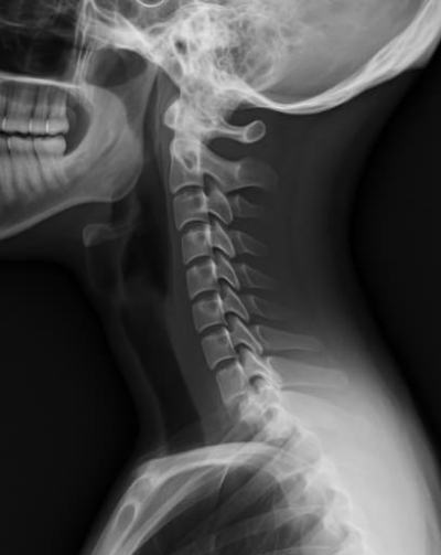 거북목 교정운동