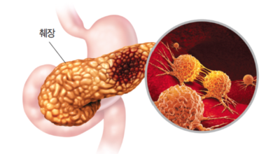 췌장에좋은음식이미지