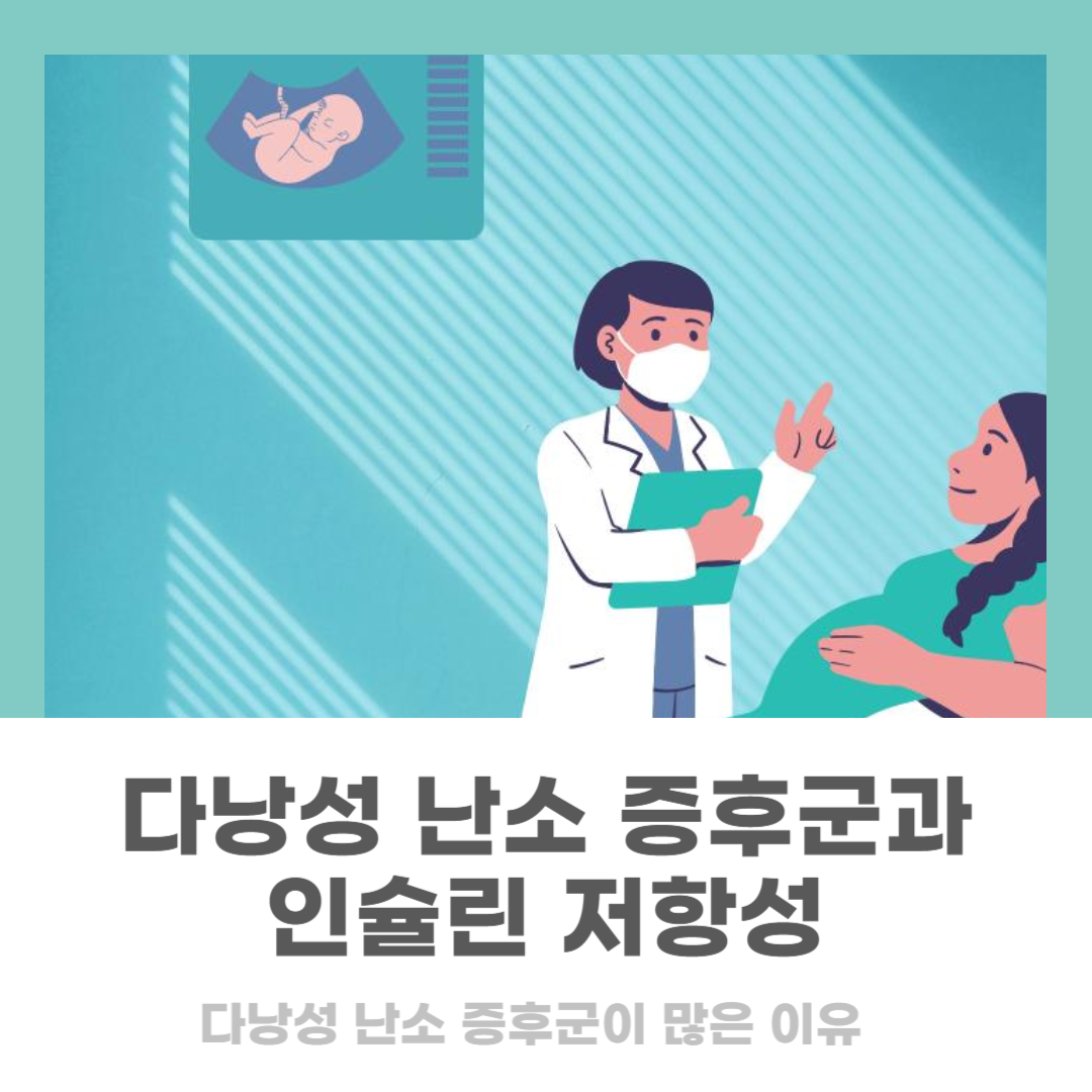 다낭성 난소 증후군