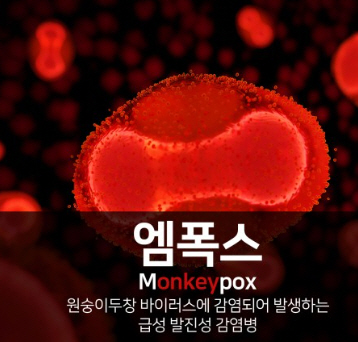 엠폭스바이러스 안내