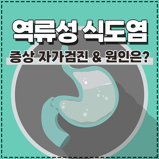 역류성 식도염 증상 자가검진 및 원인