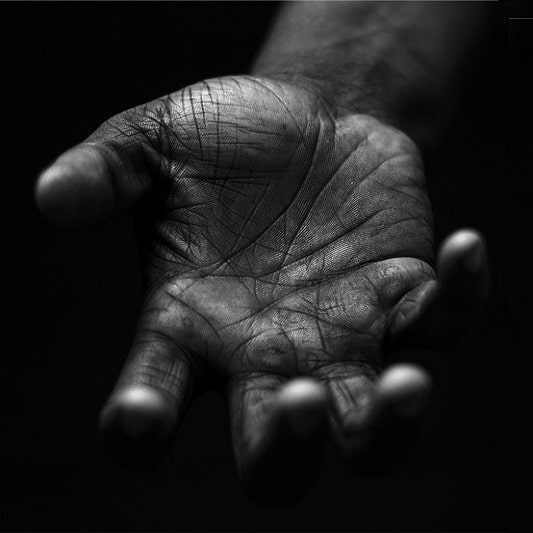 손가락 관절염 원인