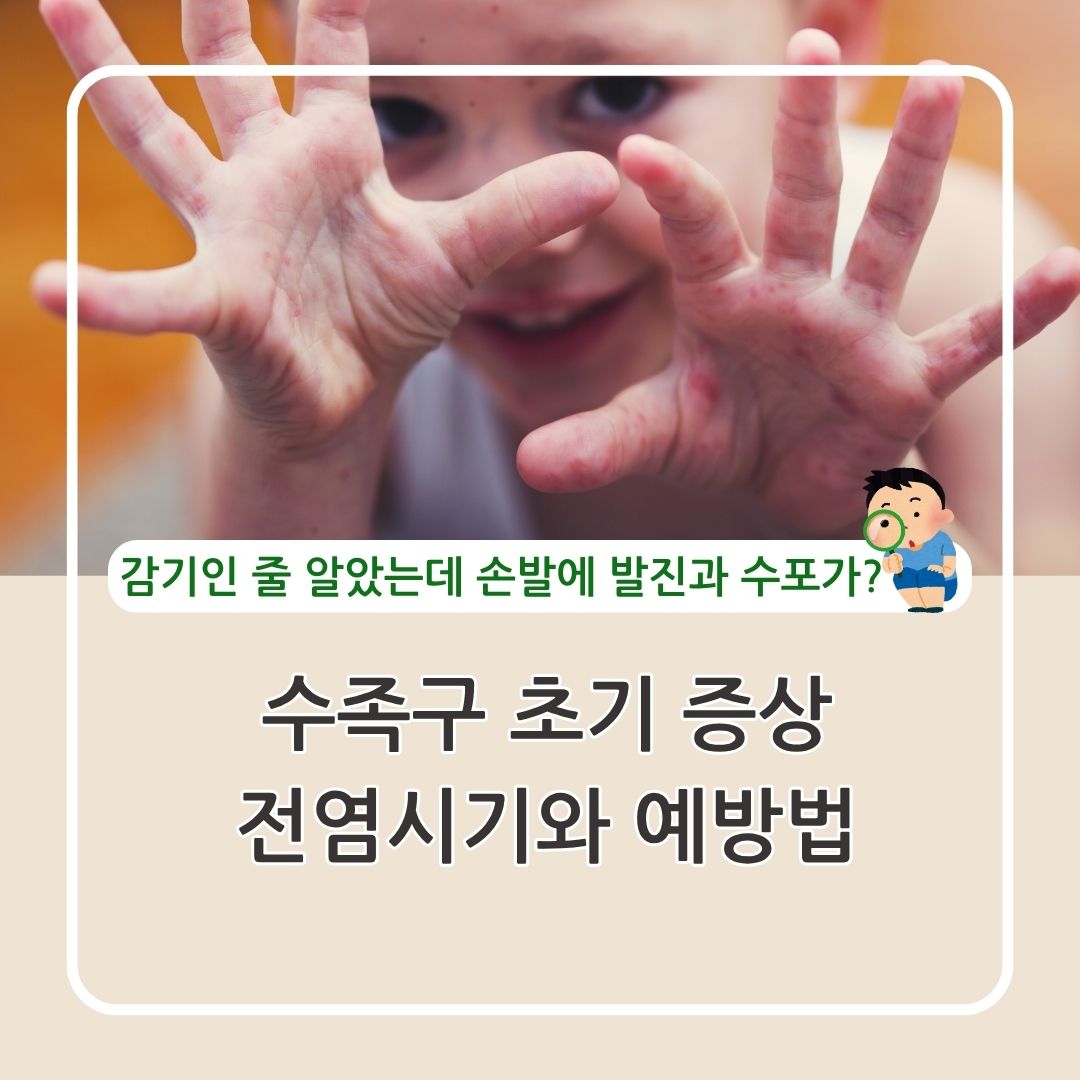 수족구 초기 증상과 대처방법