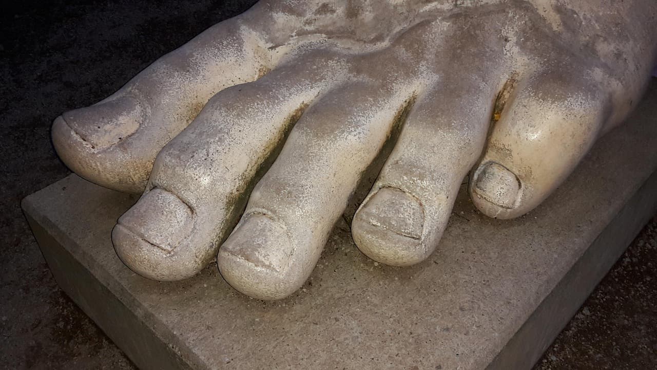 발톱무좀