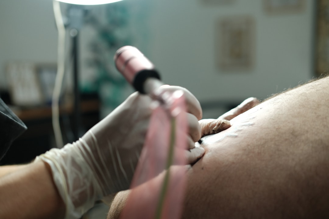 Ultrasound