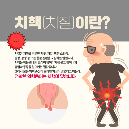치질이란?/ 출처 - 네이버블로그 [INNER PEACE]