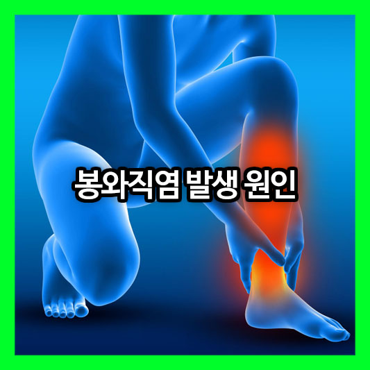 피부 깊숙이 파고드는 급성 세균 감염! 봉와직염 발생 원인과 위험 요소는?