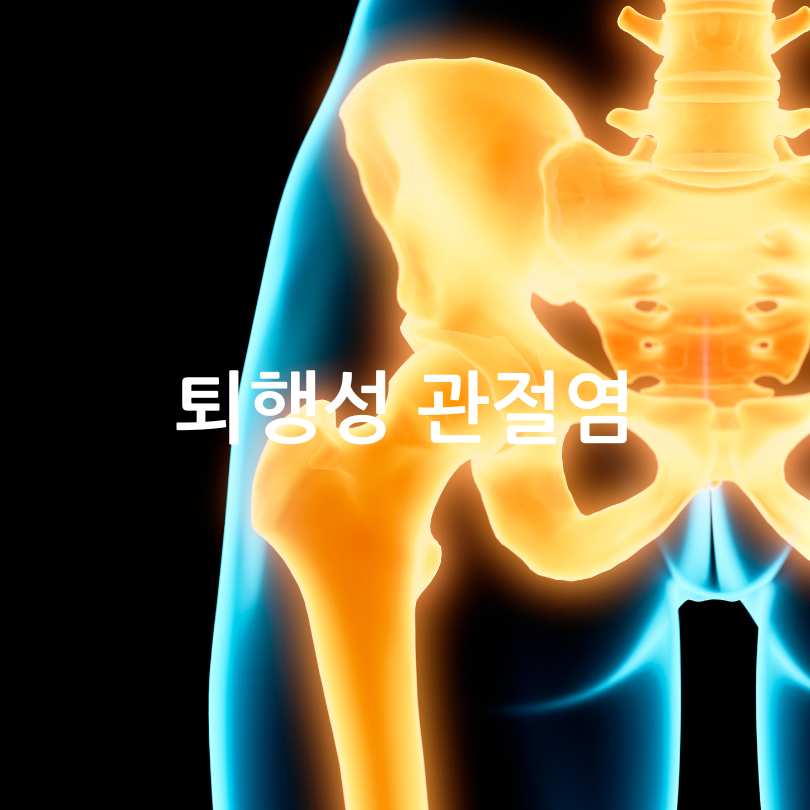 고관절통증 증상 관리법