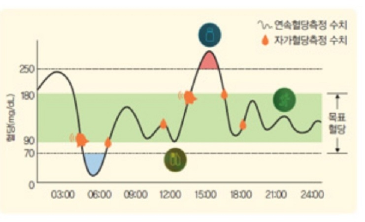 연속혈당측정-수치