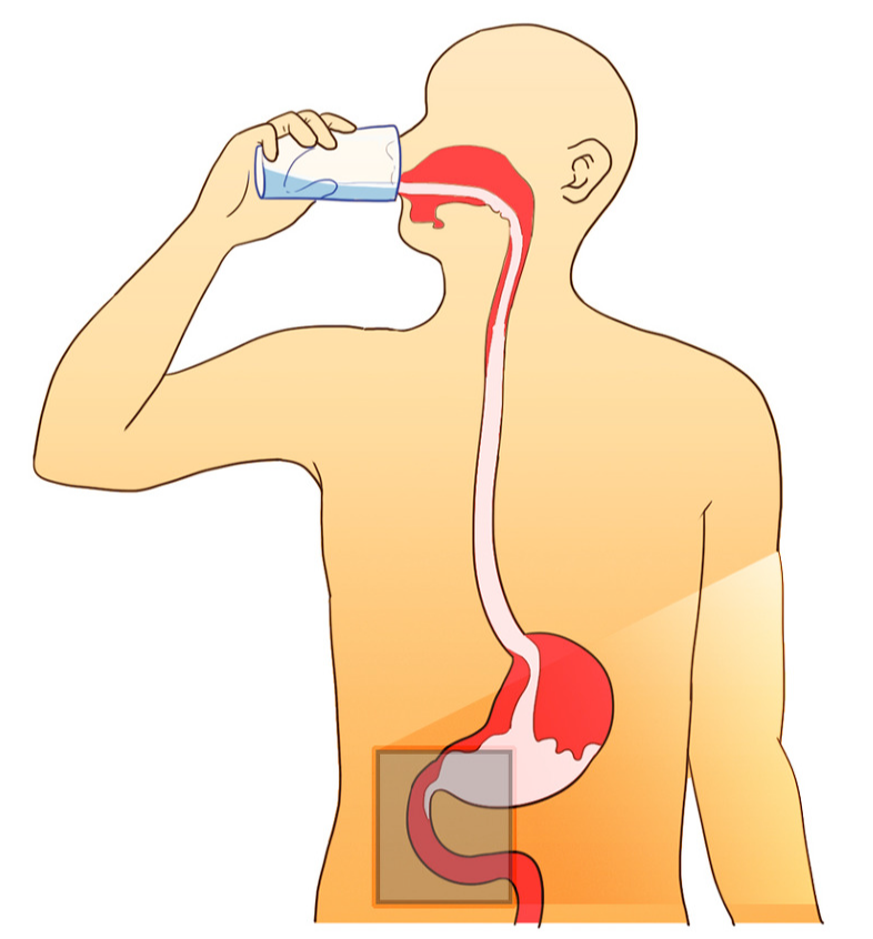 위장 조영술