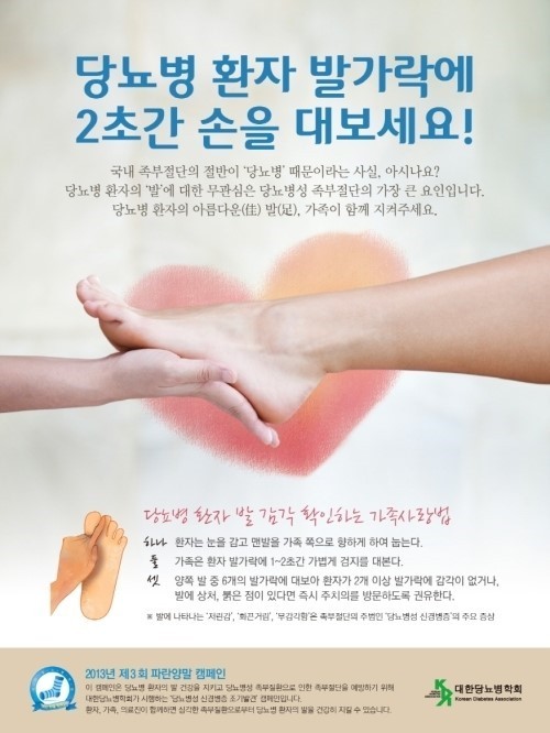 당뇨발 예방