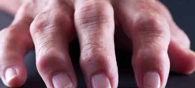 방아쇠수지증 원인&amp;#44; 증상&amp;#44; 치료 총 정리 (2025 최신)