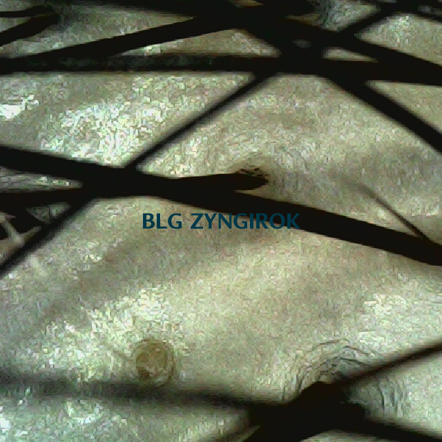 탈모 극복 프로젝트 - 정수리 두피 모습이다.