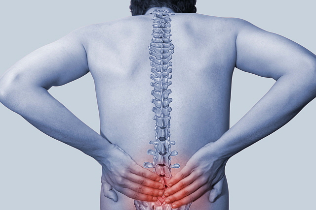 허리디스크 수술 전 MRI 판독법 초보자 가이드