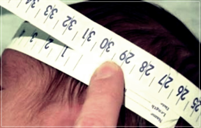 소두증 이란? 원인, 증상, 치료방법들