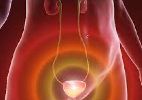 요실금 치료방법