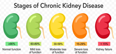 소변 사진/출처:어도비스톡