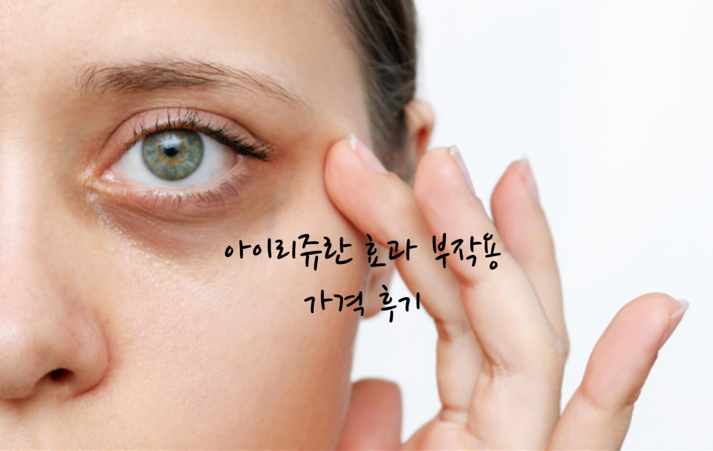 아이리쥬란 효과