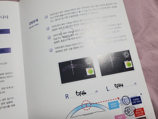 리지안안과 검사결과지