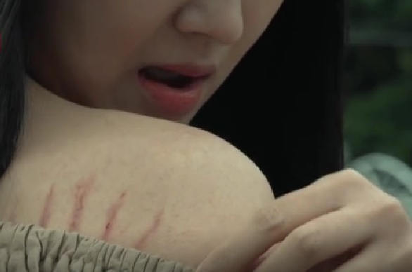 얼룩진 원피스