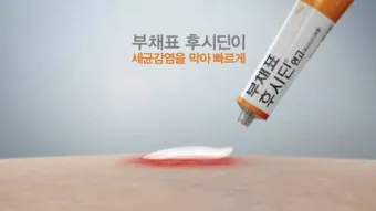 후시딘 효능 효과 알아보기로 정리_22