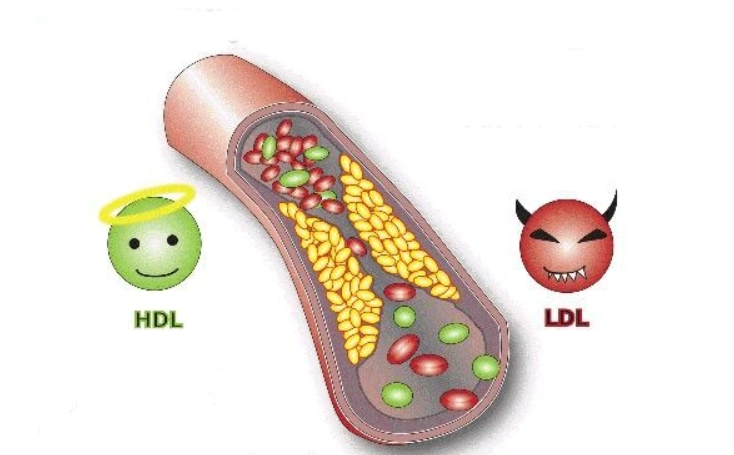HDL-콜레스테롤-낮으면-HDL-콜레스테롤-높으면