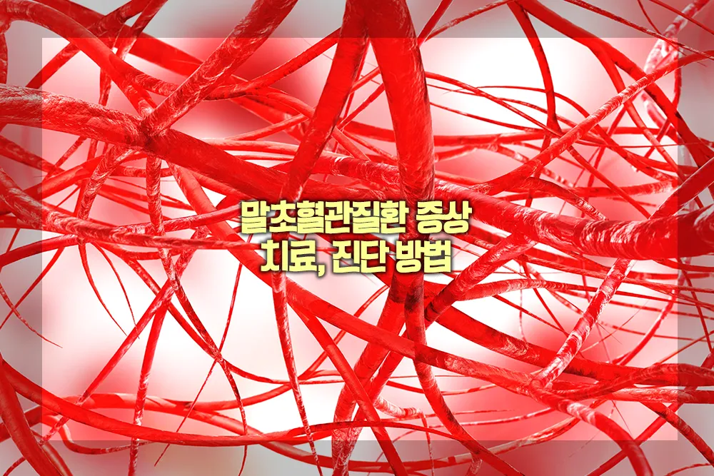 말초혈관질환 증상 치료 진단