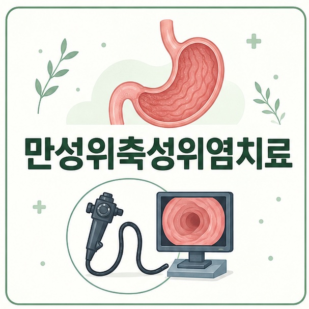 위의 단순한 해부학 그림과 내시경 아이콘을 배치하고 ‘만성위축성위염치료’라는 제목을 표시한 건강 정보 이미지