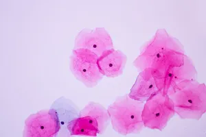 자궁경부암-예방접종