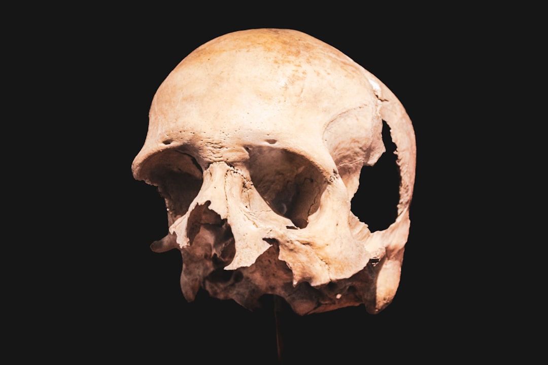 Parathyroid